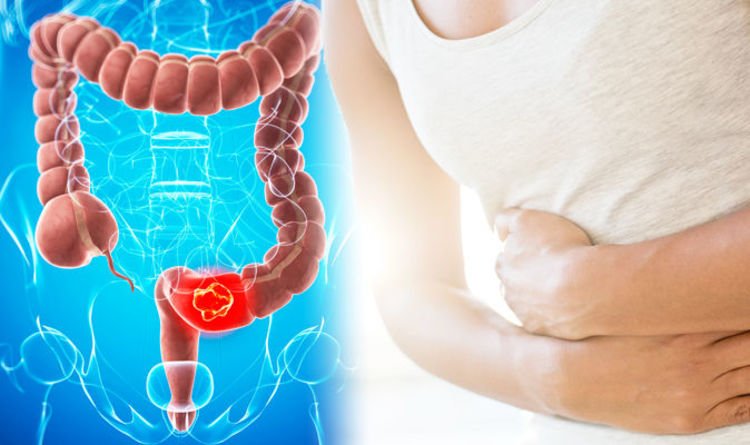Bowel Cancer: This is the first symptom of cancer in the intestine, if you have this problem in the stomach, then immediately talk to the doctor.